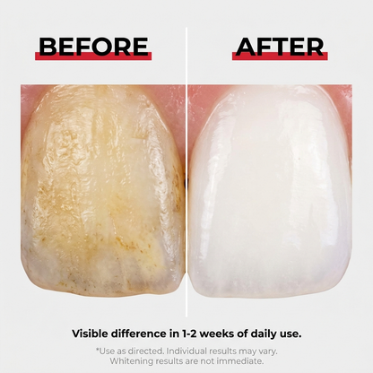 Wellania™ Stain Whitening Mouthwash